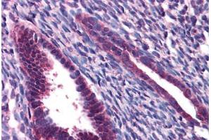 Human Uterus: Formalin-Fixed, Paraffin-Embedded (FFPE) (JMJD1C Antikörper  (N-Term))