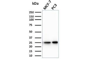 Western Blot Analysis of MCF-7, PC3 cell lysate using CHP2 Mouse Monoclonal Antibody (CPTC-CHP2-1). (Chp2 Antikörper)