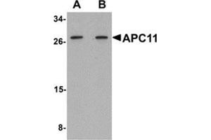 Western blot analysis of APC11 in 3T3 cell tissue lysate with APC11 antibody at (A) 1 and (B) 2 μg/ml. (ANAPC11 Antikörper  (Center))