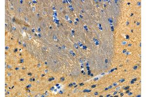 ABIN6265218 and ABIN6277933 at 1/100 staining Mouse brain tissue by IHC-P.