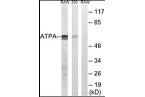 MT-ATP6 antibody  (Subunit alpha)