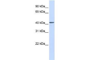 WB Suggested Anti-NOB1 Antibody Titration: 0. (NOB1 Antikörper  (C-Term))