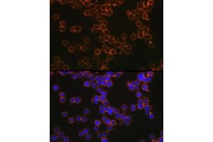 Immunofluorescence analysis of U-937 cells using CD209 Rabbit pAb (ABIN1679076, ABIN5663916, ABIN5663918 and ABIN6218556) at dilution of 1:100 (40x lens). (DC-SIGN/CD209 Antikörper  (AA 265-404))
