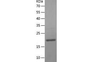 NHP2 Protein (AA 1-153) (His tag)