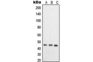 Western blot analysis of RELT expression in HeLa (A), T47D (B), COLO205 (C) whole cell lysates.