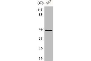 Western Blot analysis of HeLa cells using AW-1 Polyclonal Antibody (ZNF174 Antikörper  (Internal Region))
