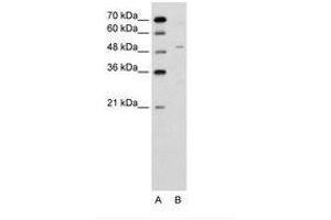 Image no. 1 for anti-Zinc Finger Protein 19 (ZNF19) (AA 51-100) antibody (ABIN6736634) (ZNF19 Antikörper  (AA 51-100))