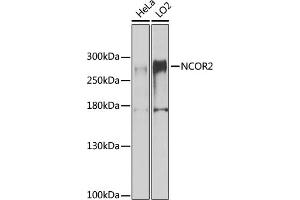 NCOR2 Antikörper  (AA 670-900)