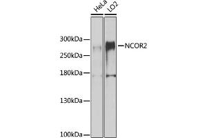 Western blot analysis of extracts of various cell lines, using NCOR2 antibody (ABIN6130575, ABIN6144422, ABIN6144423 and ABIN6224431) at 1:1000 dilution. (NCOR2 Antikörper  (AA 670-900))