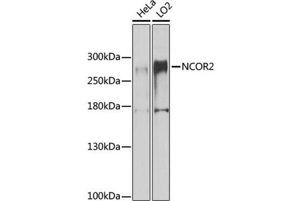 NCOR2 antibody  (AA 670-900)