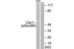 Western blot analysis of extracts from K562 cells treated with Na3VO4 0. (CHEK1 Antikörper  (pSer286))