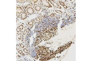 IHC analysis of MCM2 using anti-MCM2 antibody (ABIN7601593).