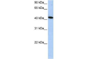 WB Suggested Anti-ICA1L Antibody Titration: 0. (ICA1L Antikörper  (Middle Region))