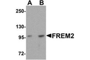 Western blot analysis of FREM2 in A-20 cell lysate with FREM2 antibody at (A) 0.