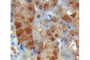 Used in DAB staining on fromalin fixed paraffin-embedded Kidney tissue (Adrenomedullin Antikörper  (AA 24-171))