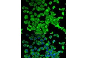Immunofluorescence analysis of MCF7 cells using PARN Polyclonal Antibody (PARN Antikörper)