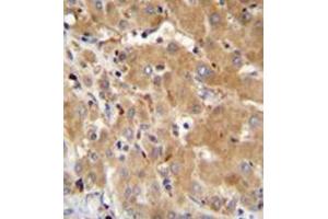 Formalin fixed and paraffin embedded human liver tissue reacted with GGH Antibody (N-term) followed by peroxidase conjugation of the secondary antibody and DAB staining.