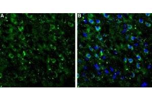 Expression of mGluR7 in rat neocortex - Immunohistochemical staining of rat neocortex frozen sections using Anti-mGluR7 (extracellular) Antibody (ABIN7043255, ABIN7044346 and ABIN7044347).