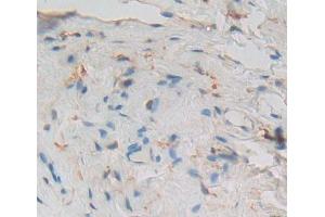 Used in DAB staining on fromalin fixed paraffin- embedded Kidney tissue (PCM1 Antikörper  (AA 1913-2024))