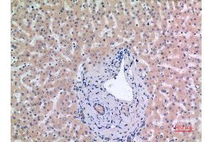 Immunohistochemistry (IHC) image for anti-Minichromosome Maintenance Complex Component 7 (MCM7) (Internal Region) antibody (ABIN6284183)