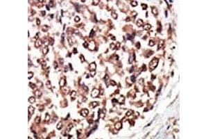 Immunohistochemistry (IHC) image for anti-Protein Kinase D3 (PRKD3) (AA 860-890) antibody (ABIN3032381)