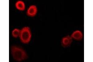 Immunofluorescent analysis of NDUFS4 staining in HepG2 cells. (NDUFS4 Antikörper)