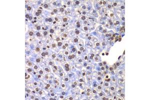 Immunohistochemistry of paraffin-embedded mouse liver using ULK4 antibody (ABIN5975557) at dilution of 1/100 (40x lens). (ULK4 Antikörper)