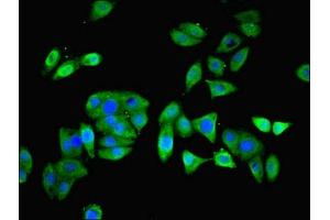 Immunofluorescent analysis of HepG2 cells using ABIN7164219 at dilution of 1:100 and Alexa Fluor 488-congugated AffiniPure Goat Anti-Rabbit IgG(H+L) (PFDN5 Antikörper  (AA 2-154))