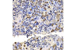 Immunohistochemistry of paraffin-embedded rat spleen using UBE2V2 antibody (ABIN5975744) at dilution of 1/100 (40x lens). (UBE2V2 Antikörper)