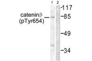 Western blot analysis of extracts from 293 cells, using Catenin-beta (Phospho-Tyr654) Antibody. (beta Catenin Antikörper  (pTyr654))