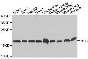 Western blot analysis of extracts of various cell lines, using PPIB antibody. (PPIB Antikörper  (AA 34-216))