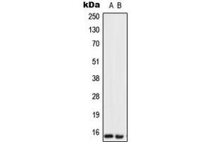 Western blot analysis of Urotensin 2 expression in SKBR3 (A), U251MG (B) whole cell lysates. (Urotensin 2 Antikörper  (Center))