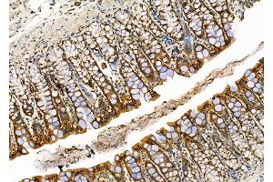 ABIN6264315 and ABIN6276587 at 1/100 staining Rat stomach tissue by IHC-P. (PML Antikörper  (N-Term))
