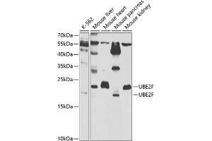 Western blot analysis of extracts of various cell lines, using UBE2F antibody  at 1:1000 dilution. (UBE2F Antikörper  (AA 1-185))