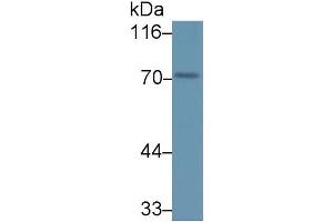 Detection of PADI1 in Mouse Testis lysate using Polyclonal Antibody to Peptidyl Arginine Deiminase Type I (PADI1) (PADI1 Antikörper  (AA 298-556))