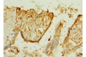 Immunohistochemistry of paraffin-embedded human placenta tissue using ABIN7164617 at dilution of 1:100 (TTLL2 Antikörper  (AA 401-592))