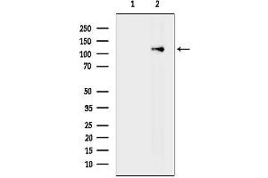 Western blot analysis of lysates from VERO cells(H2O2 treatment), using E-cadherin Antibody.