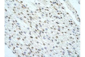 Rabbit Anti-KHSRP Antibody   Paraffin Embedded Tissue: Human Heart cell Cellular Data: cardiac cell of renal tubule Antibody Concentration: 4.
