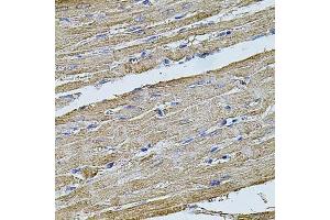 Immunohistochemistry (Paraffin-embedded Sections) (IHC (p)) image for anti-Filamin B, beta (FLNB) (AA 1686-1785) antibody (ABIN1679857)