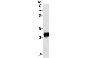 Gel: 8 % SDS-PAGE, Lysate: 50 μg, Lane: Human liver cancer tissue, Primary antibody: ABIN7129664(GSTO1 Antibody) at dilution 1/200, Secondary antibody: Goat anti rabbit IgG at 1/8000 dilution, Exposure time: 20 seconds