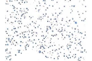 Immunocytochemistry (ICC) image for anti-CD28 (CD28) (AA 170-220) antibody (ABIN7455122) (Rekombinanter CD28 Antikörper  (AA 170-220))