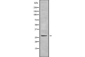 Western blot analysis of PEX11A using LOVO whole cell lysates (PEX11A Antikörper  (Internal Region))