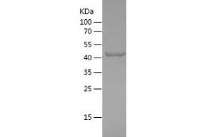 Western Blotting (WB) image for K(lysine) Acetyltransferase 2B (KAT2B) (AA 1864-2068) protein (His-IF2DI Tag) (ABIN7123658) (KAT2B Protein (AA 1864-2068) (His-IF2DI Tag))