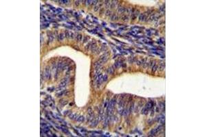 Immunohistochemistry analysis in formalin fixed and paraffin embedded human uterus tissue reacted with Ghrelin receptor / GHSR Antibody (C-term) followed by peroxidase conjugation of the secondary antibody and DAB staining. (GHSR Antikörper  (C-Term))
