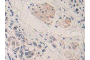 Immunohistochemistry (IHC) image for anti-Matrix Metallopeptidase 24 (Membrane-inserted) (MMP24) (AA 429-642) antibody (ABIN7441787)