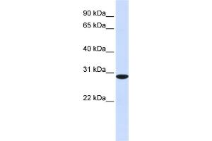 WB Suggested Anti-RPA4 Antibody Titration: 0. (RPA4 Antikörper  (C-Term))