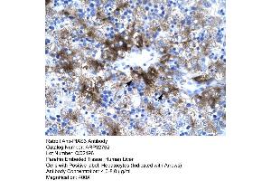 Human Liver (PIAS3 Antikörper  (C-Term))