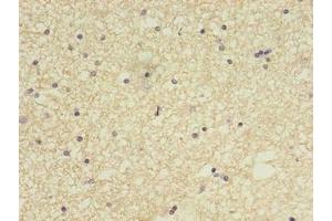Immunohistochemistry of paraffin-embedded human brain tissue using ABIN7148084 at dilution of 1:100 (CCDC134 Antikörper  (AA 23-229))