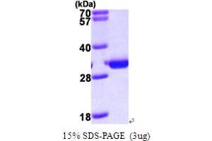 SDS-PAGE (SDS) image for Phosphomannomutase 2 (PMM2) (AA 1-246) protein (His tag) (ABIN667222) (PMM2 Protein (AA 1-246) (His tag))