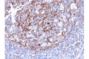 Immunohistochemistry (IHC) image for anti-Complement Component (3d/Epstein Barr Virus) Receptor 2 (CR2) (AA 142-240) antibody (ABIN6939186)